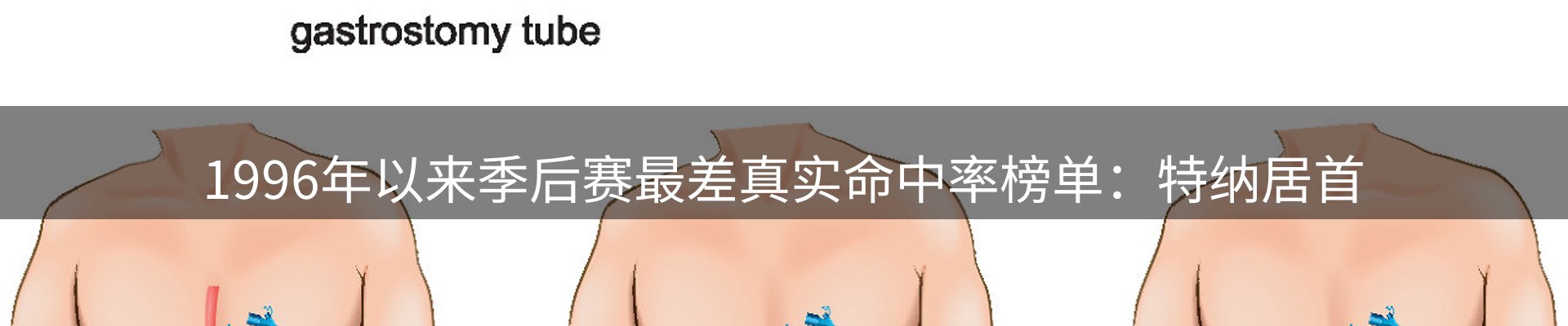 焦点动态